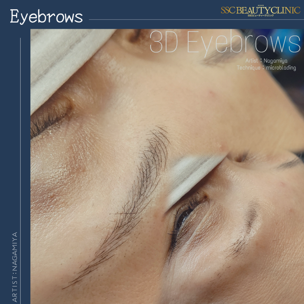 sscb_nagamiya_0830_sscbeautyclinic