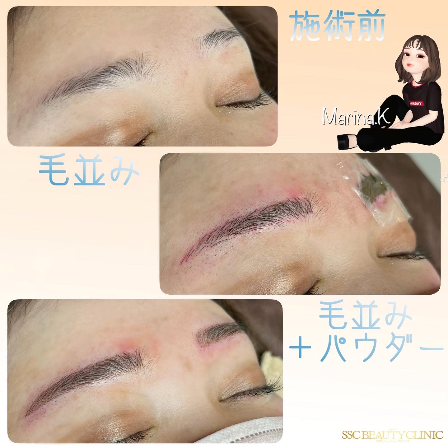 sscb_kumagai_eyebrow_0818