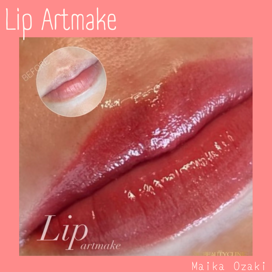 sscb_ozaki_0817_sscbeautyclinic_lip